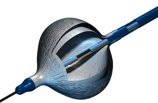 Arctic Front Cardiac cryoAblation Catheter System