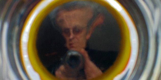 penampakan hidrosefalus