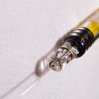 Vaksin Ultrasound: Tanpa Jarum, Tanpa Nyeri